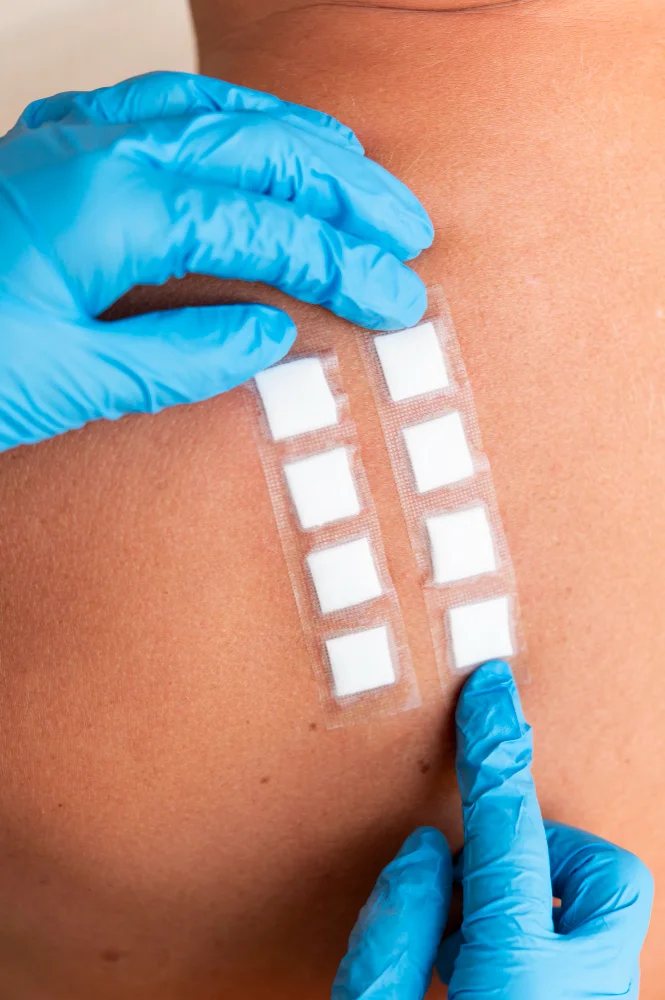Skin Allergy test in Kolkata, Allergy skin patch tests in Kolkata, patch test for allergy in kolkata, skin patch test clinic in kolkata, Patch Testing for Skin Allergies Kolkata
