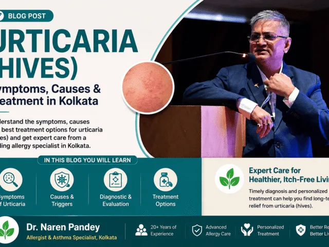 Urticaria (Hives) Treatment in Kolkata: Causes, Symptoms & Permanent Relief | Dr. Naren Pandey