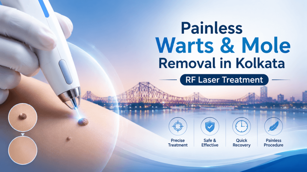 Warts and mole removal in Kolkata using RF laser treatment